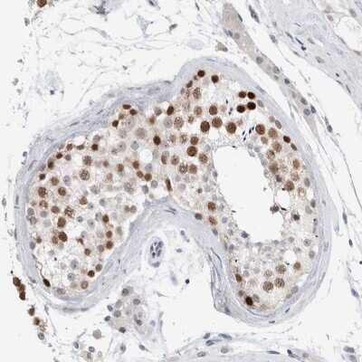 Immunohistochemistry-Paraffin: CASC5 Antibody [NBP1-89223] - Staining of human testis shows distinct nuclear positivity in cells in seminiferus ducts.