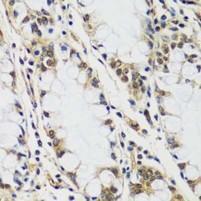 Immunohistochemistry-Paraffin: CASC5 Antibody [NBP2-92855] - Human colon using CASC5 antibody at dilution of 1:100 (40x lens).