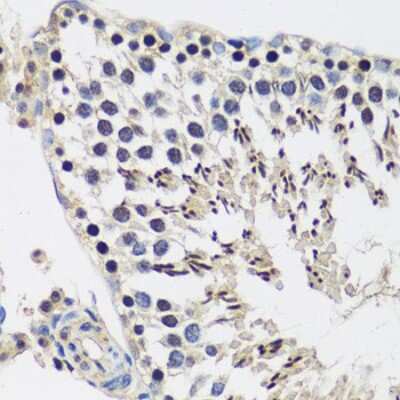 Immunohistochemistry-Paraffin: CASC5 Antibody [NBP2-92855] - Rat testis using CASC5 antibody at dilution of 1:100 (40x lens).