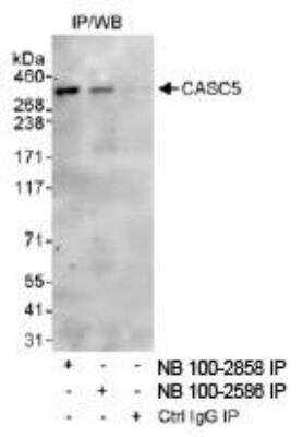 Immunoprecipitation: CASC5 Antibody [NB100-2585] - Detection of Human CASC5 on HeLa whole cell lysate using NB100-2585. CASC5 was also immunoprecipitated by rabbit anti-CASC5 antibody NB100-2586.