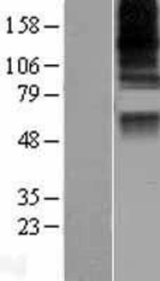Western Blot: CASD1 Overexpression Lysate (Adult Normal) [NBL1-08702] Left-Empty vector transfected control cell lysate (HEK293 cell lysate); Right -Over-expression Lysate for CASD1.