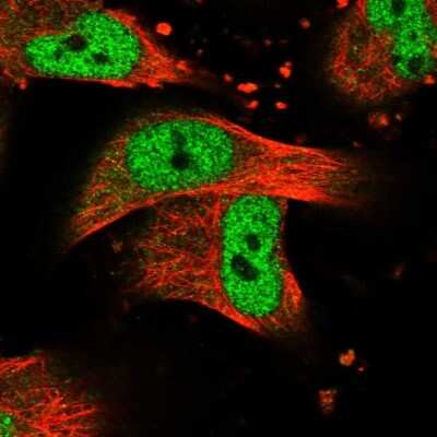 Immunocytochemistry/Immunofluorescence: CASK Antibody [NBP1-86673] - Staining of human cell line U-251 MG shows localization to nucleoplasm.