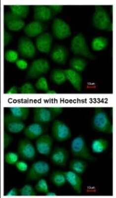 Immunocytochemistry/Immunofluorescence: CASK Antibody [NBP2-15710] - Immunofluorescence analysis of paraformaldehyde-fixed A431, using antibody at 1:500 dilution.