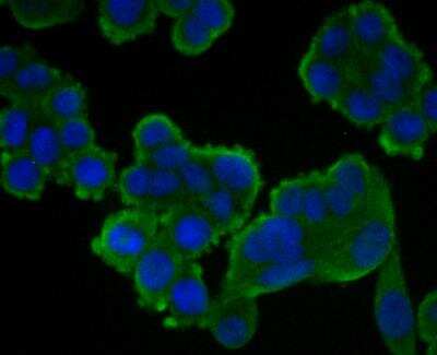 Immunocytochemistry/Immunofluorescence: CASK Antibody [NBP2-76922] - ICC staining CASK in HT-29 cells (green). The nuclear counter stain is DAPI (blue). Cells were fixed in paraformaldehyde, permeabilised with 0.25% Triton X100/PBS.