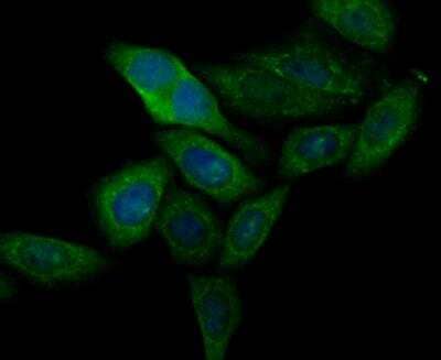 Immunocytochemistry/Immunofluorescence: CASK Antibody [NBP2-76922] - ICC staining CASK in SiHa cells (green). The nuclear counter stain is DAPI (blue). Cells were fixed in paraformaldehyde, permeabilised with 0.25% Triton X100/PBS.