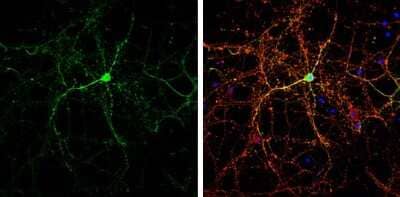 Immunocytochemistry/Immunofluorescence: CASK Antibody [NBP3-13185] - CASK antibody detects CASK protein by immunofluorescent analysis. Sample: DIV14 rat E18 primary cortical neurons were fixed in 4% paraformaldehyde at RT for 15 min. Green: CASK protein stained by CASK antibody (NBP3-13185) diluted at 1:500. Red: beta Tubulin 3/ Tuj1, stained by beta Tubulin 3/ Tuj1 antibody [GT1338] (NBP3-13505) diluted at 1:500. Blue: Fluoroshield with DAPI.