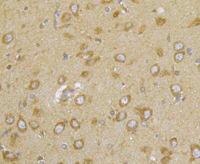 Immunohistochemistry: CASK Antibody [NBP2-76922] - Immunohistochemical analysis of paraffin-embedded rat brain tissue using anti-CASK antibody. Counter stained with hematoxylin.