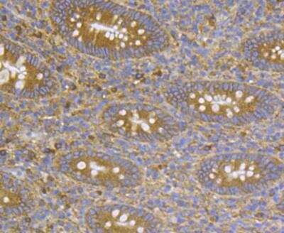 Immunohistochemistry: CASK Antibody [NBP2-76922] - Immunohistochemical analysis of paraffin-embedded human appendix tissue using anti-CASK antibody. Counter stained with hematoxylin.