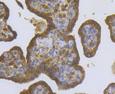 Immunohistochemistry: CASK Antibody [NBP2-76922] - Immunohistochemical analysis of paraffin-embedded human placenta tissue using anti-CASK antibody. Counter stained with hematoxylin.