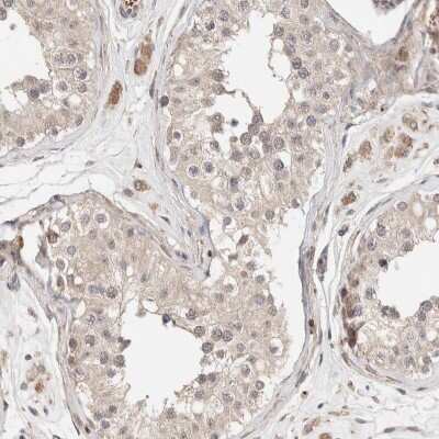 Immunohistochemistry-Paraffin: CASK Antibody [NBP1-86673] - Staining of human testis shows low expression as expected.