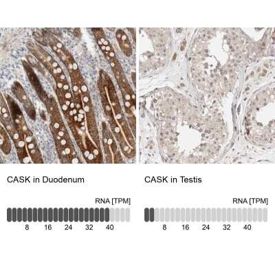 <b>Orthogonal Strategies Validation. </b>Immunohistochemistry-Paraffin: CASK Antibody [NBP1-86673] - Staining in human duodenum and testis tissues using anti-CASK antibody. Corresponding CASK RNA-seq data are presented for the same tissues.