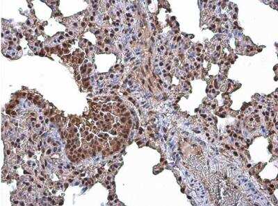 Immunohistochemistry-Paraffin: CASK Antibody [NBP2-15710] - Paraffin-embedded mouse lung.  CASK antibody diluted at 1:500.