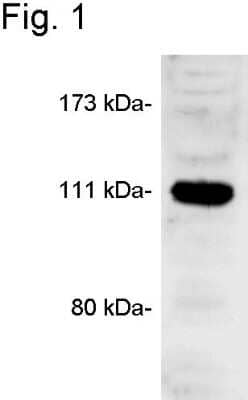 Western Blot: CASK Antibody [NB300-321] - Analysis of AtT20 cell lysate.