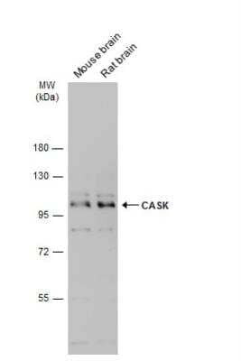 Western Blot: CASK Antibody [NBP2-15710] - Various tissue extracts (50 ug) were separated by 7.5% SDS-PAGE, and the membrane was blotted with CASK antibody diluted at 1:3000. The HRP-conjugated anti-rabbit IgG antibody (NBP2-19301) was used to detect the primary antibody.