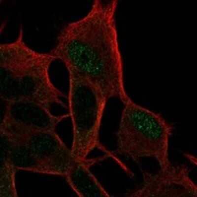 Immunocytochemistry/ Immunofluorescence CASK Interacting Protein 1 Antibody