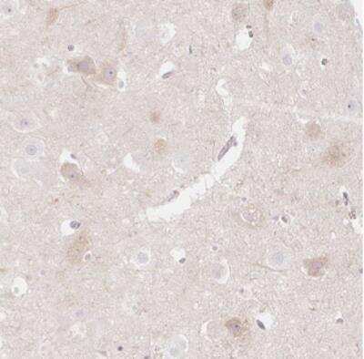 Immunohistochemistry: CASK Interacting Protein 1 Antibody [NBP2-30414] - Staining of human hippocampus shows moderate cytoplasmic positivity in neuronal cells.