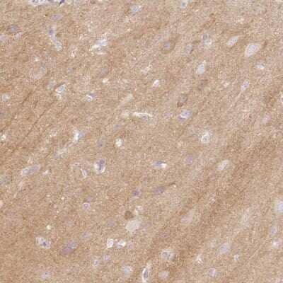 Immunohistochemistry-Paraffin CASK Interacting Protein 1 Antibody