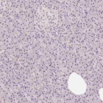 Immunohistochemistry-Paraffin CASK Interacting Protein 1 Antibody