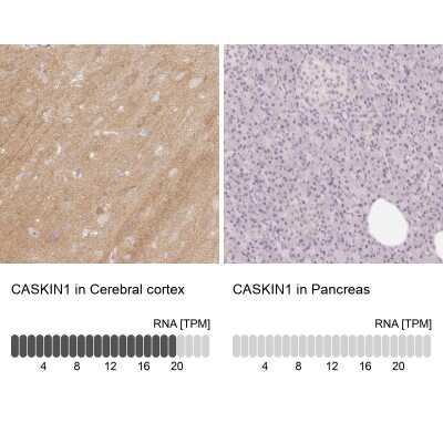 Immunohistochemistry-Paraffin CASK Interacting Protein 1 Antibody