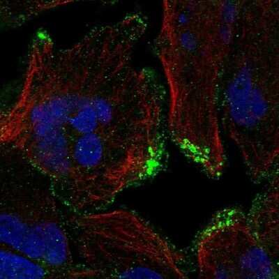 Immunocytochemistry/Immunofluorescence: CASKIN2 Antibody [NBP2-68999] - Staining of human cell line RH-30 shows localization to plasma membrane.