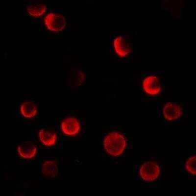 Immunocytochemistry/ Immunofluorescence CASKIN2 Antibody - BSA Free