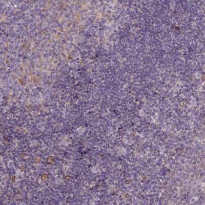 Immunohistochemistry-Paraffin: CASKIN2 Antibody [NBP2-62674] - Staining of human tonsil shows low expression as expected.