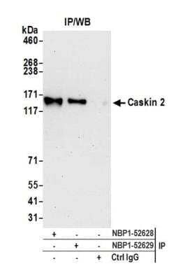 Immunoprecipitation: CASKIN2 Antibody [NBP1-52628] - Detection of human Caskin 2 by western blot of immunoprecipitates. Samples: Whole cell lysate (1.0 mg per IP reaction; 20% of IP loaded) from HeLa cells prepared using NETN lysis buffer. Antibodies: Affinity purified rabbit anti-Caskin 2 antibody NBP1-52628 used for IP at 3 ug per reaction. Caskin 2 was also immunoprecipitated by rabbit anti-Caskin 2 antibody NBP1-52629. For blotting immunoprecipitated Caskin 2, NBP1-52628 was used at 1 ug/ml. Detection: Chemiluminescence with an exposure time of 30 seconds.