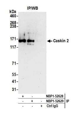 <b>Independent Antibodies Validation. </b>Immunoprecipitation: CASKIN2 Antibody [NBP1-52629] - Detection of human Caskin 2 by western blot of immunoprecipitates. Samples: Whole cell lysate (1.0 mg per IP reaction; 20% of IP loaded) from HeLa cells prepared using NETN lysis buffer. Antibodies: Affinity purified rabbit anti-Caskin 2 antibodyNBP1-52629 used for IP at 3 ug per reaction. Caskin 2 was also immunoprecipitated by rabbit anti-Caskin 2 antibody NBP1-52628. For blotting immunoprecipitated Caskin 2, NBP1-52629 was used at 1 ug/ml. Detection: Chemiluminescence with an exposure time of 30 seconds.