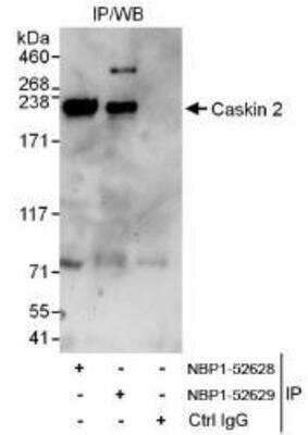 <b>Independent Antibodies Validation. </b>Western Blot: CASKIN2 Antibody [NBP1-52628] - Whole cell lysate (1 mg for IP, 20% of IP loaded) from HeLa cells.  Antibodies: Affinity purified rabbit anti-Caskin 2 antibody  used for IP at 6 mcg/mg lysate.  Caskin 2 was also immunoprecipitated by rabbit anti-Caskin 2 antibody NBP1-52629, which recognizes a downstream epitope.