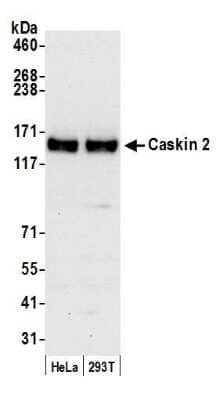 Western Blot CASKIN2 Antibody