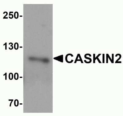 Western Blot CASKIN2 Antibody - BSA Free