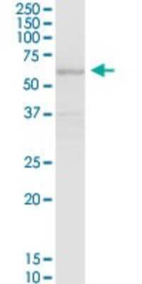 Western Blot: CAT1 Antibody [H00006541-B01P] - Analysis of SLC7A1 expression in human liver.