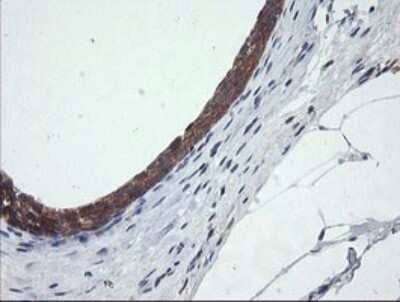 Immunohistochemistry: CATIP Antibody (OTI4B4) - Azide and BSA Free [NBP2-72506] - Analysis of Human bladder tissue.