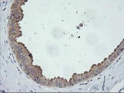 Immunohistochemistry: CATIP Antibody (OTI4B4) - Azide and BSA Free [NBP2-72506] - Analysis of Human breast tissue.