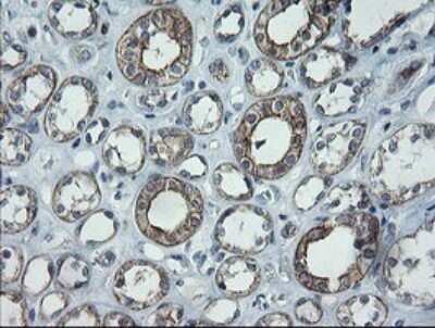 Immunohistochemistry: CATIP Antibody (OTI4B4) - Azide and BSA Free [NBP2-72506] - Analysis of Human Kidney tissue.