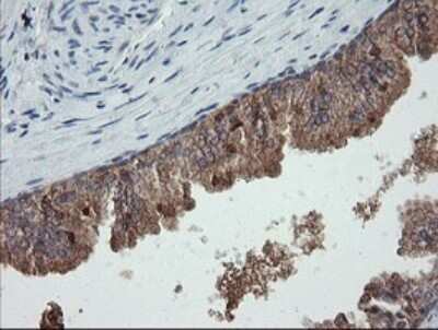 Immunohistochemistry: CATIP Antibody (OTI4B4) - Azide and BSA Free [NBP2-72506] - Analysis of Human prostate tissue.