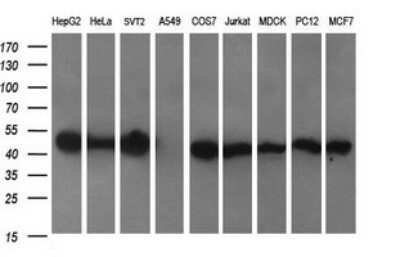 Western Blot: CATIP Antibody (OTI4B4) - Azide and BSA Free [NBP2-72506] - Analysis of extracts (35ug) from 9 different cell lines by using C2orf62 monoclonal antibody (HepG2: human; HeLa: human; SVT2: mouse; A549: human; COS7: monkey; Jurkat: human; MDCK: canine; PC12: rat; MCF7: human)