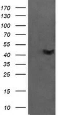 Western Blot: CATIP Antibody (OTI4B4) - Azide and BSA Free [NBP2-72506] - Analysis of HEK293T cells were transfected with the pCMV6-ENTRY control (Left lane) or pCMV6-ENTRY C2orf62 .
