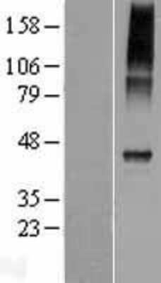Western Blot CATSPER4 Overexpression Lysate