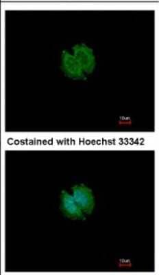 Immunocytochemistry/ Immunofluorescence CATSPERB Antibody