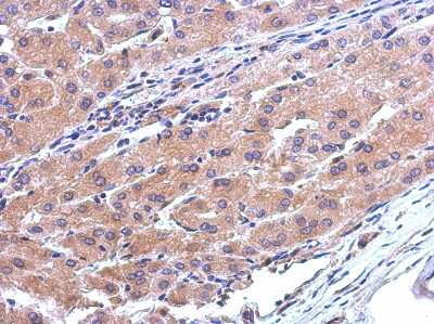 Immunohistochemistry-Paraffin CATSPERB Antibody