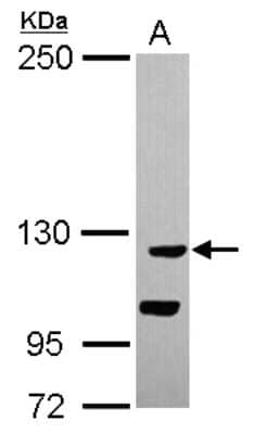 Western Blot CATSPERB Antibody