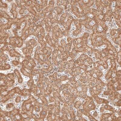 Immunohistochemistry-Paraffin: CBARA1 Antibody [NBP1-86663] - Staining of human liver shows moderate granular positivity in cytoplasm in hepatocytes.