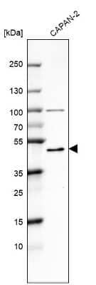 Western Blot: CBARA1 Antibody [NBP2-58173] - Analysis in human cell line CAPAN-2.
