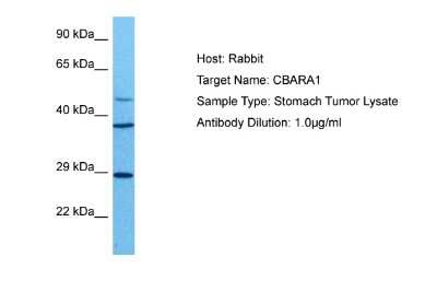 Western Blot: CBARA1 Antibody [NBP2-87129] - Host: Rabbit. Target Name: CBARA1. Sample Tissue: Human Stomach Tumor lysates. Antibody Dilution: 1ug/ml