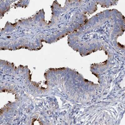 Immunohistochemistry-Paraffin: CBCP6 Antibody [NBP1-91754] - Staining of human fallopian tube shows cilia positivity in glandular cells.