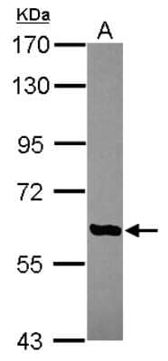 Western Blot: CBCP6 Antibody [NBP2-15729] - Sample (30 ug of whole cell lysate) A: Hep G2 7. 5% SDS PAGE gel, diluted at 1:1000.