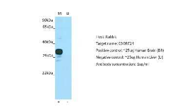 Western Blot CBE1 Antibody - BSA Free