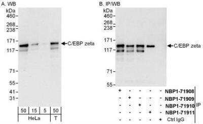 Western Blot: CBF2 Antibody [NBP1-71908] - Whole cell lysate from HeLa (15 and 50 mcg for WB; 1 mg for IP, 20% of IP loaded) and 293T (T; 50 mcg) cells.  Affinity purified rabbit anti-C/EBP zeta antibody used for WB at 0.1 mcg/ml (A) and 1 mcg/ml (B) and used for IP at 6 mcg/mg lysate.  C/EBP zeta was also immunoprecipitated by rabbit anti-C/EBP zeta antibodies NBP1-71909, NBP1-71910 and NBP1-71911, which recognize downstream epitopes.