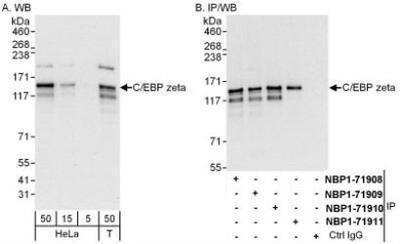 Western Blot: CBF2 Antibody [NBP1-71909] - Whole cell lysate from HeLa (15 and 50 mcg for WB; 1 mg for IP, 20% of IP loaded) and 293T (T; 50 mcg) cells.   Antibodies: Affinity purified rabbit anti-C/EBP zeta antibody  used for WB at 0.04 mcg/ml (A) and 1 mcg/ml (B) and used for IP at 6 mcg/mg lysate.  C/EBP zeta was also immunoprecipitated by rabbit anti-C/EBP zeta antibodies NBP1-71908, NBP1-71910 and NBP1-71911, which recognize other epitopes.